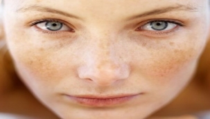 Hamilelikte Oluşan Cilt Lekeleri İçin Ne Yapabilirim?