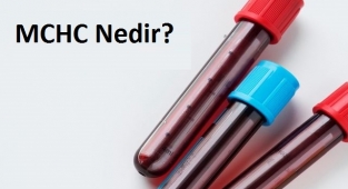 MCHC Nedir?