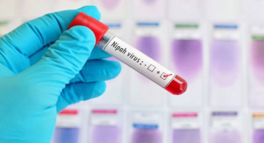 Nipah Virüsü Nedir? Nipah Virüsü Enfeksiyonu Nasıl Önlenir?