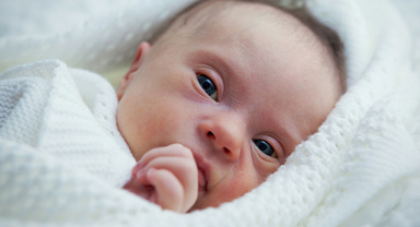 Edward Sendromu Nedir? (Trizomi 18)