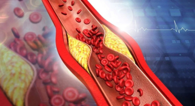 Yüksek Kolesterol Nedir?