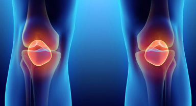 Dizlerde Kireçlenme Sebepleri