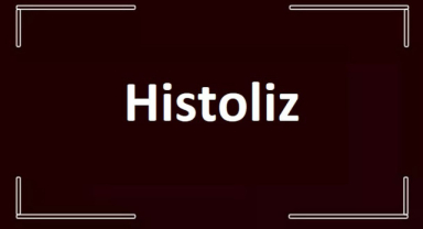 Histoliz